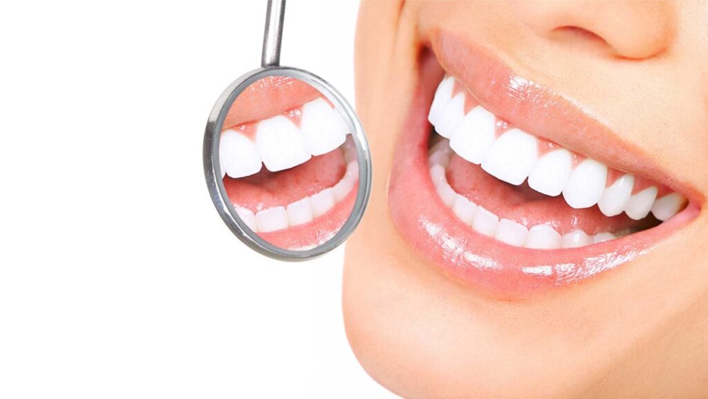 Що варто знати про вибілювання зубів Київ?